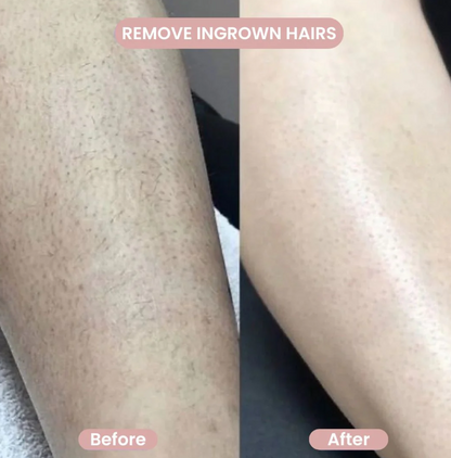 SmoothShave